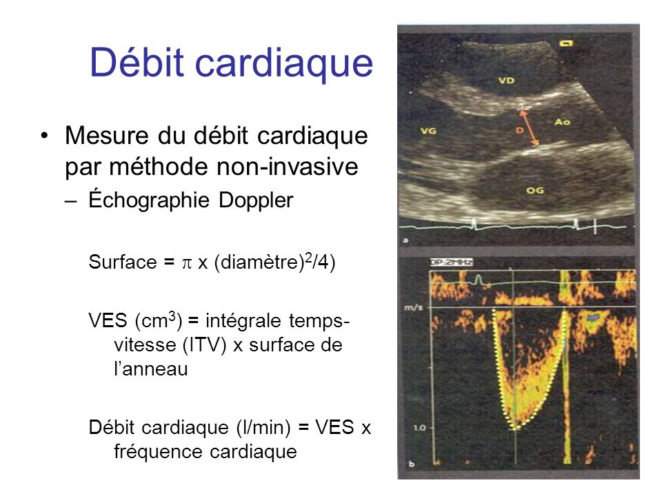 Ntroduire Imagen Formule D Bit Cardiaque Fr Thptnganamst Edu Vn